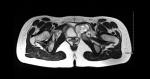 0 NMSP Circulation A21 - Bone case B1b.jpg